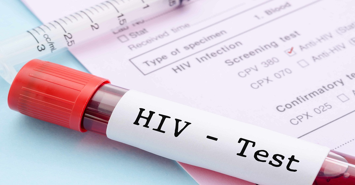 Kabar Gembira...!!! Ini Temuan Baru Anti HIV Dengan Antibodi 3BNC117