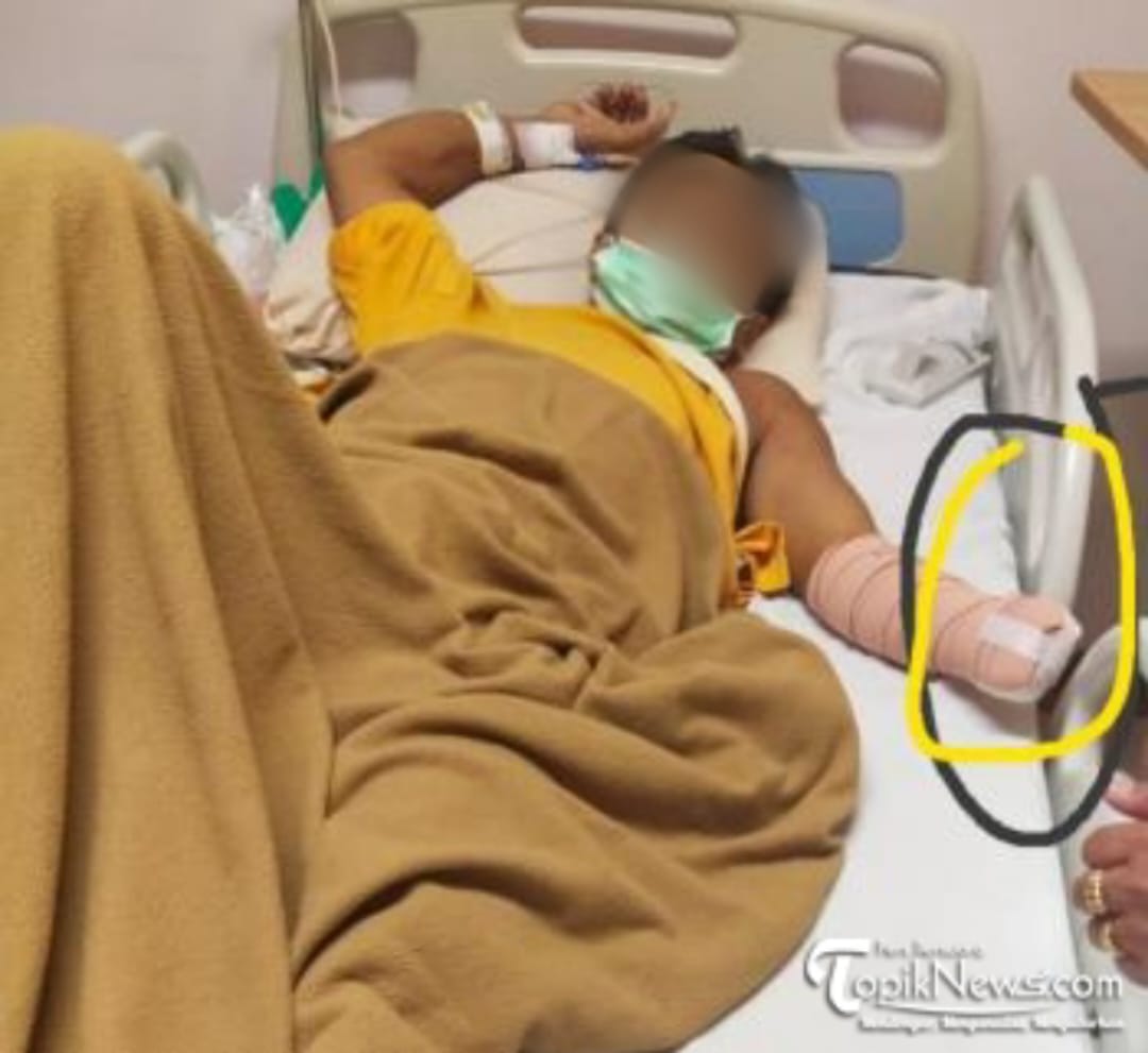 Akibat Terkena Egrek Jatuh, Tangan Kiri Karyawan PT SP Putus