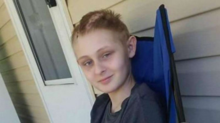 Organ Mau Disumbangkan, Bocah Korban Kecelakaan Ini Bangun