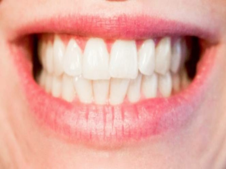 Awas, Bahaya Pemutih Gigi Instan yang Pasti Bikin Menyesal
