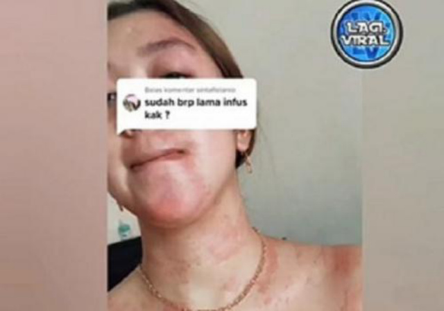 Viral Perempuan Nyesal Suntik Putih, Apakah Treatment seperti Itu Boleh Dilakukan?