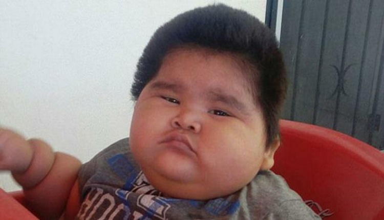 Luis Manuel Bayi 10 Bulan dengan Berat 30 Kilogram