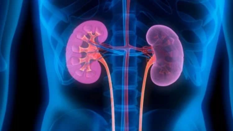 Jual Ginjal Demi Beli iPhone, Nasib Pria Ini Berakhir Tragis