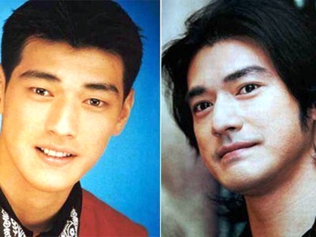 Banyak Pria Lakukan Operasi Bibir di Masa Kini