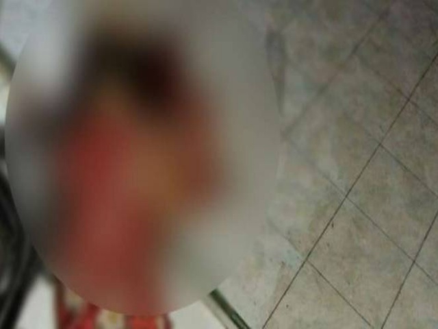 Polda Sumut Bentuk 3 Tim Buru Pembunuh Satu Keluarga