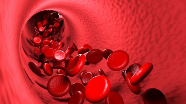 4 Penyebab Pembuluh Darah Bisa Pecah, Hipertensi Salah Satunya