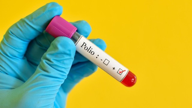 Polio Kembali di Bumi Belahan Barat Setelah 30 Tahun Punah