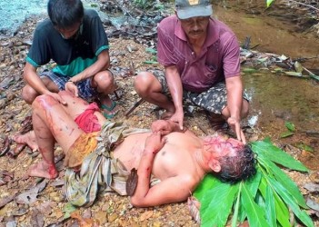 Diserang Beruang saat Mencari Ikan, Warga Kampar Terluka Serius