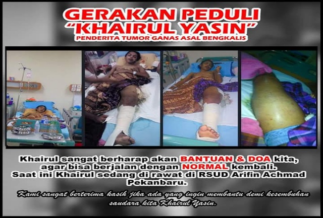 Khairul Yasin, Penderita Tumor Ganas di Bengkalis yang Mengharapkan Bantuan Pengobatan