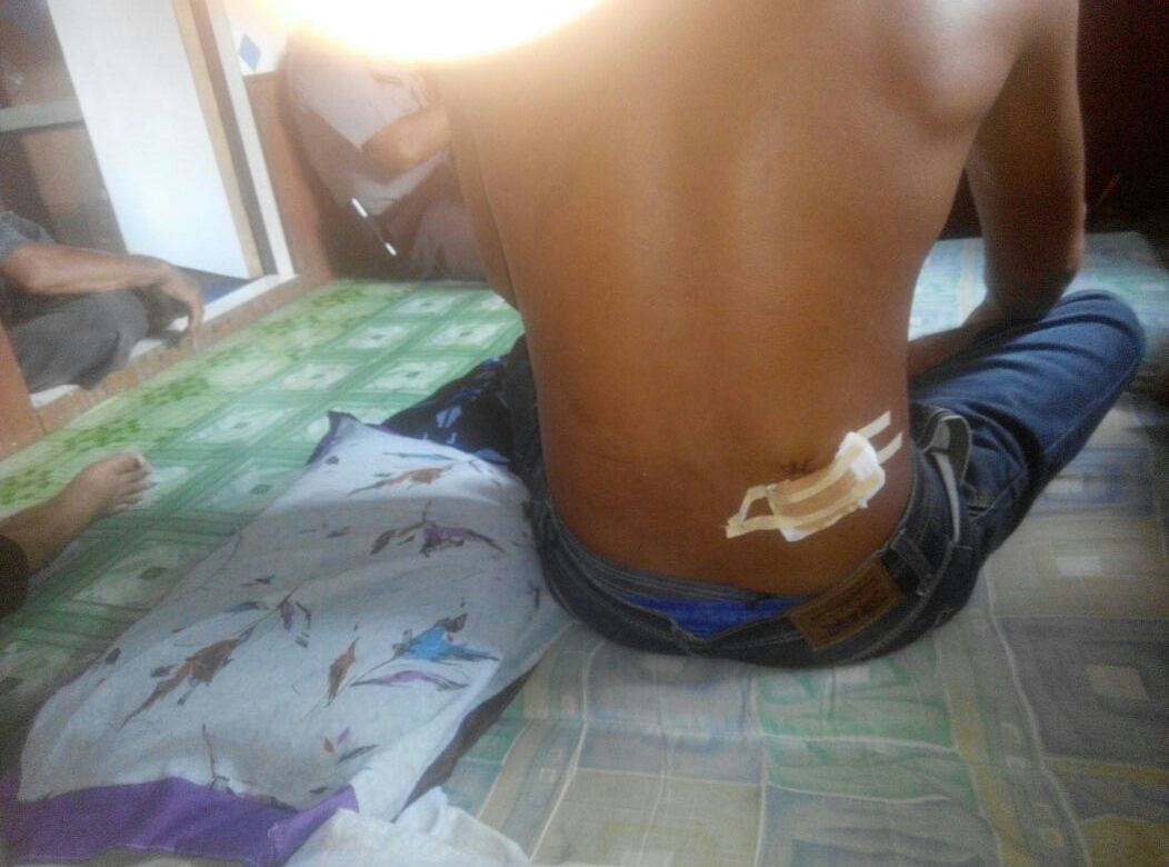 Akibat Perselisihan, Warga Inhil Nyaris Tewas Dikeroyok