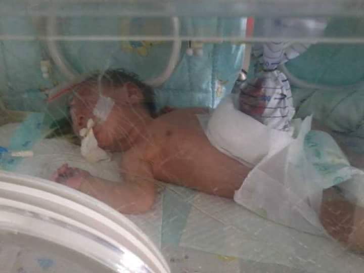Pasca Operasi, Kondisi Bayi Usus Keluar dari Kabupaten Inhil Mulai Stabil