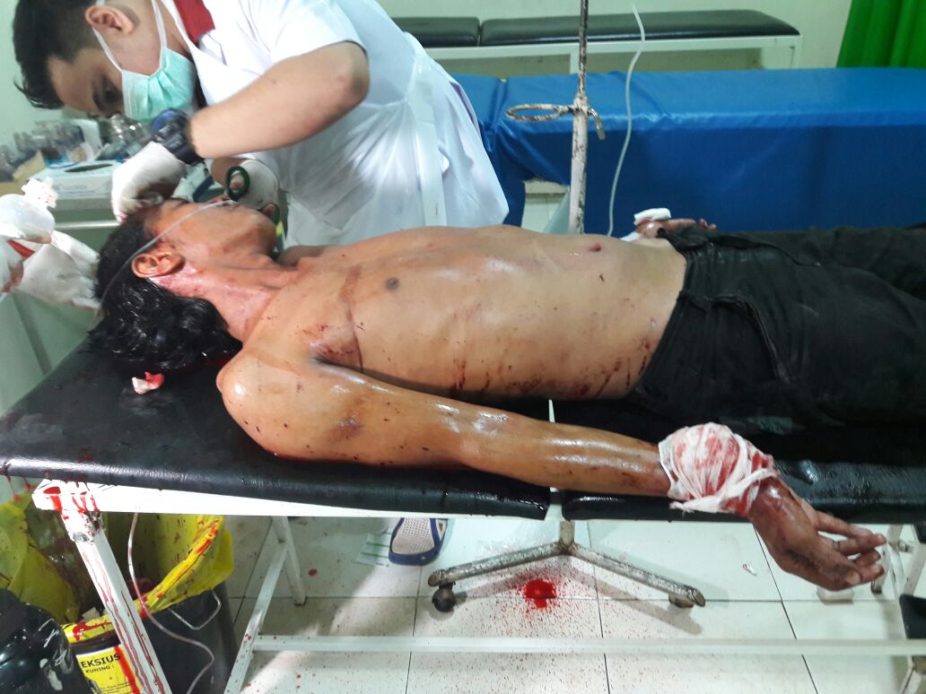 Tukang Becak di Inhil Adu Bacok, 1 Orang Mengalami Luka-luka